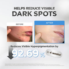 Dark Spot Corrector,Hyperpigmentation Treatment, Glowing Skin Serum, Sensitive Skin Care, Hydrating Ampoule, K Beauty Skincare, Skin Barrier Repair, Even Skin Tone, Centella Skincare, Facial Serum, Korean Beauty Products, Radiant Skin Care - Makeustashpk