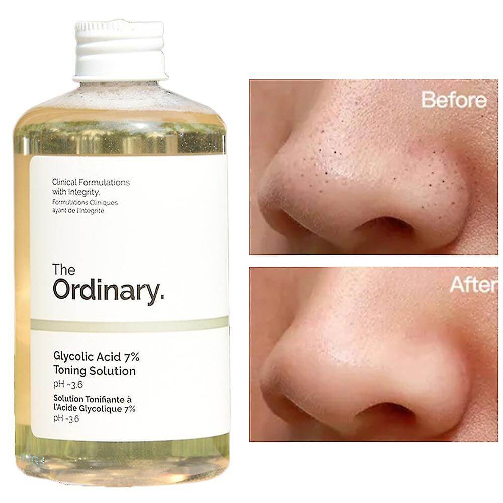 The Ordinary Glycolic Acid 7% Toning Solution - Makeup Stash  Pakistan