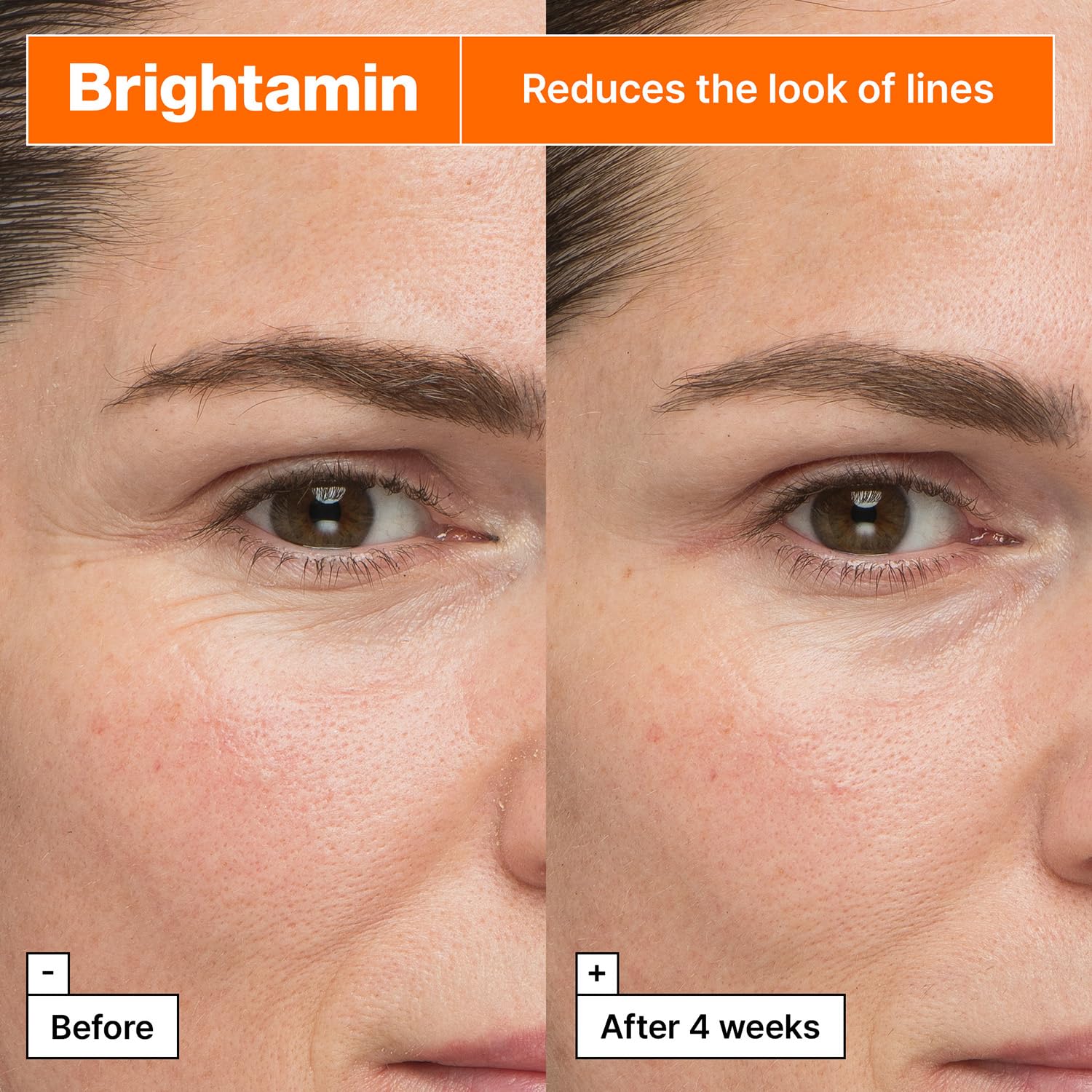 Brightamin ampoule, vitamin C serum, brightening serum, glow skin serum, Korean skincare serum, dark spot treatment, pigmentation serum - Makeup Stash Pakistan