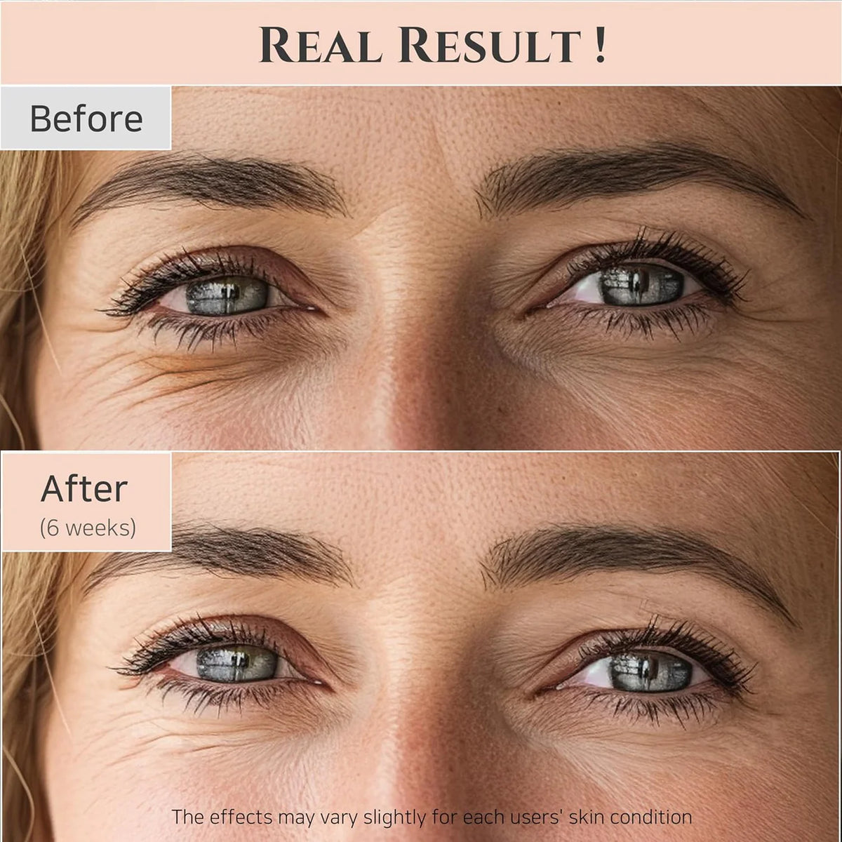 Eye Serum, Ginseng Eye Cream, Retinal Eye Serum, Anti Aging Eye Cream, Dark Circle Treatment, Wrinkle Eye Cream, Korean Eye Serum, Eye Care Skincare, Firming Eye Serum, Hydrating Eye Cream, - Makeup Stash Pakistan
