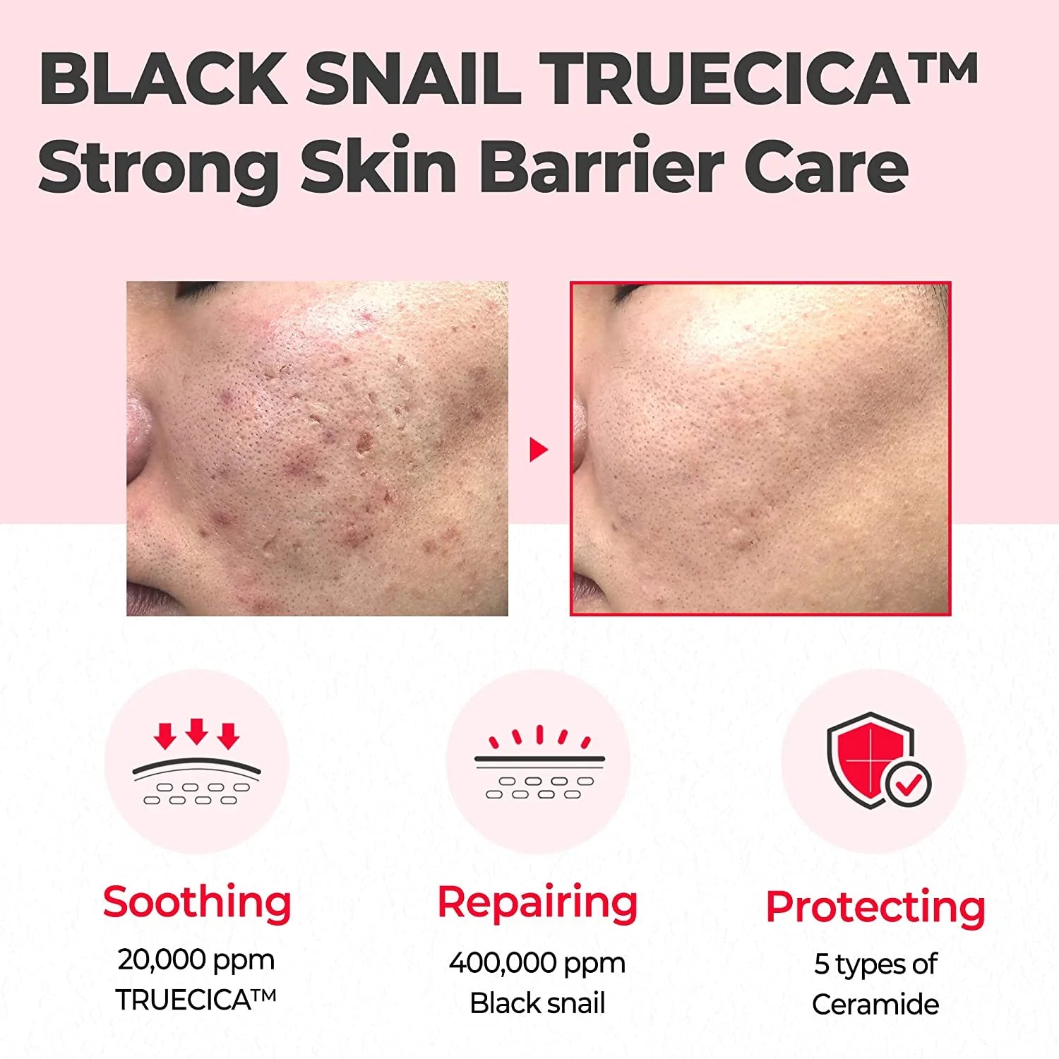 Snail Truecica Cream, Korean Repair Cream, Snail Repair Moisturizer, Acne Scar Cream, Korean Skincare Pakistan, Barrier Repair Cream, Sensitive Skin Moisturizer, Some By Mi Pakistan, Black Snail Cream, Soothing Face Cream, Hydrating Repair Cream,