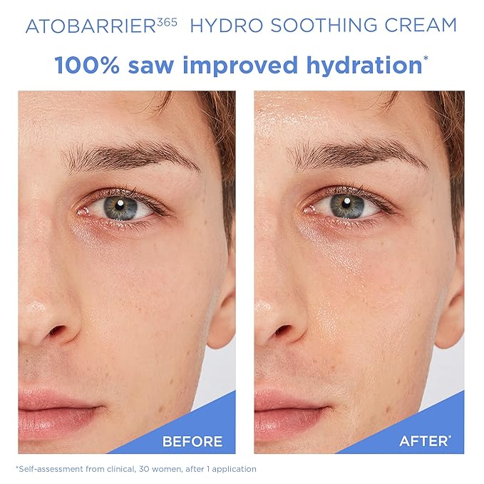 Lightweight , Barrier Repair , Moisturizer ,  for Sensitive , Makeup Stash Pakistan