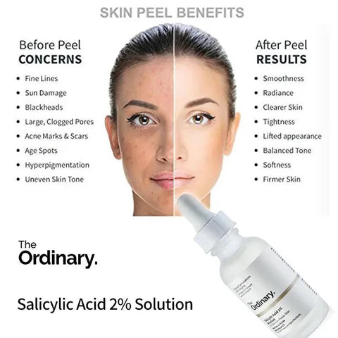 Salicylic Acid 2%, Acne Serum Pakistan, Blackhead Treatment Serum, BHA Exfoliant, Oil Control Serum, The Ordinary Pakistan, Pore Cleansing Serum, Face Serum 30ml, Skincare Pakistan - Makeup Stash Pakistan