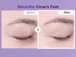 Retinol Eye Cream, Anti Aging Eye Cream, Dark Circle Treatment, Firming Eye Cream, Korean Skincare, Wrinkle Reduction, Under Eye Care, Puffiness Solution, Retinol Skincare, Youthful Eyes- Makeup Stash Pakistan