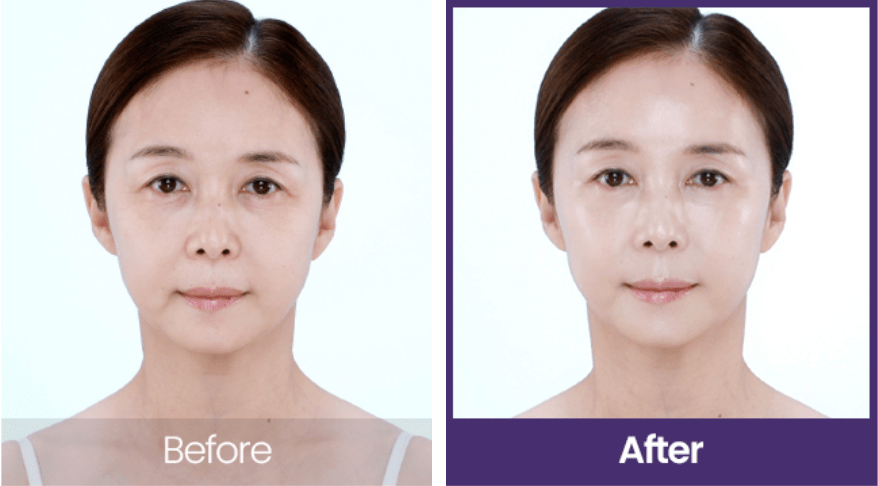  Firming, Line-Tightening, Treatment , Makeup Stash Pakistan