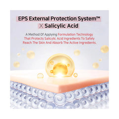 Salicylic Acid Serum, BHA Serum , Arbutin Serum, Acne Treatment Serum, Pore Minimizing Serum, Korean Skincare Serum, Oily Skin Serum, Dark Spot Corrector, Acne Marks Treatment, Clear Skin Serum, Makeup Stash Pakistan
