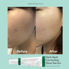 Axis-Y Dark Spot  Serum 50 ML