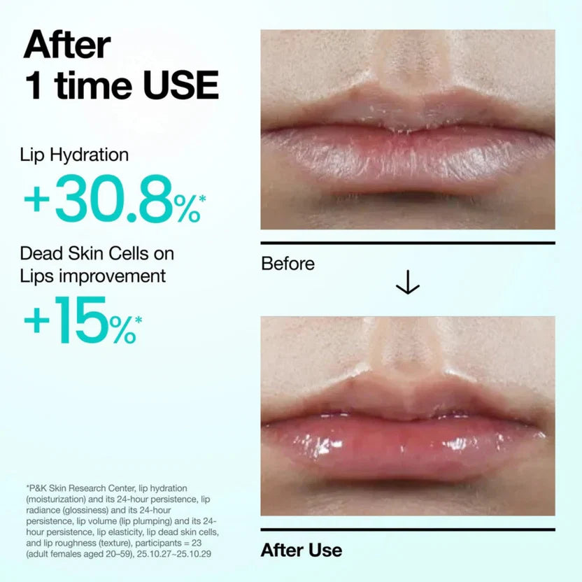 Anua, Anua Lip Serum, PDRN Lip Serum, Hyaluron Lip Serum, Hyaluronic Acid, PDRN, Lip Serum, Lip Treatment, Lip Care, Hydrating Lip Care, Moisturizing Lip Serum, Korean Skincare, Korean Beauty, Glossy Lips, Dry Lip Care - Makeupstashpk
