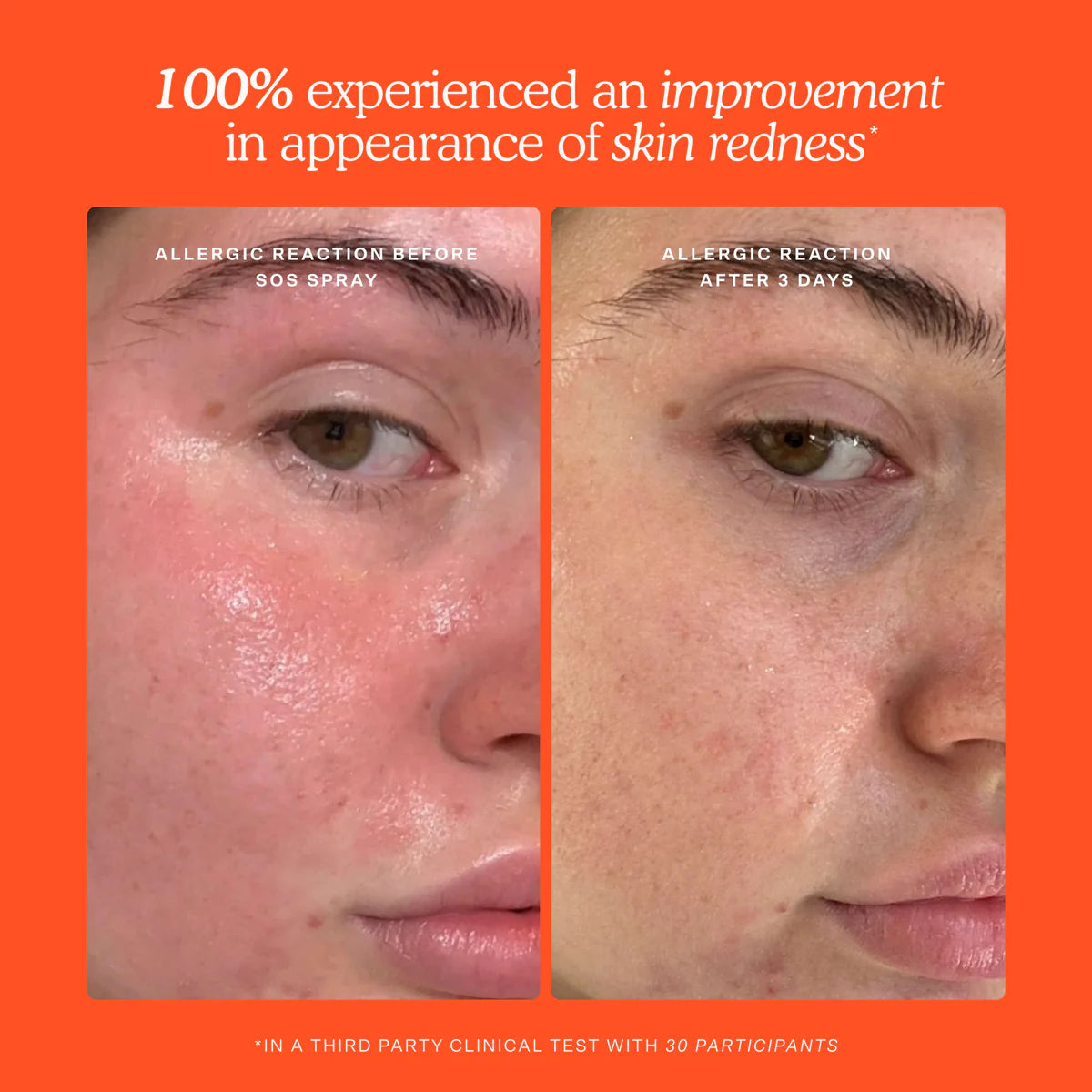 Travel Set, Sensitive Skin , Makeup Stash Pakistan