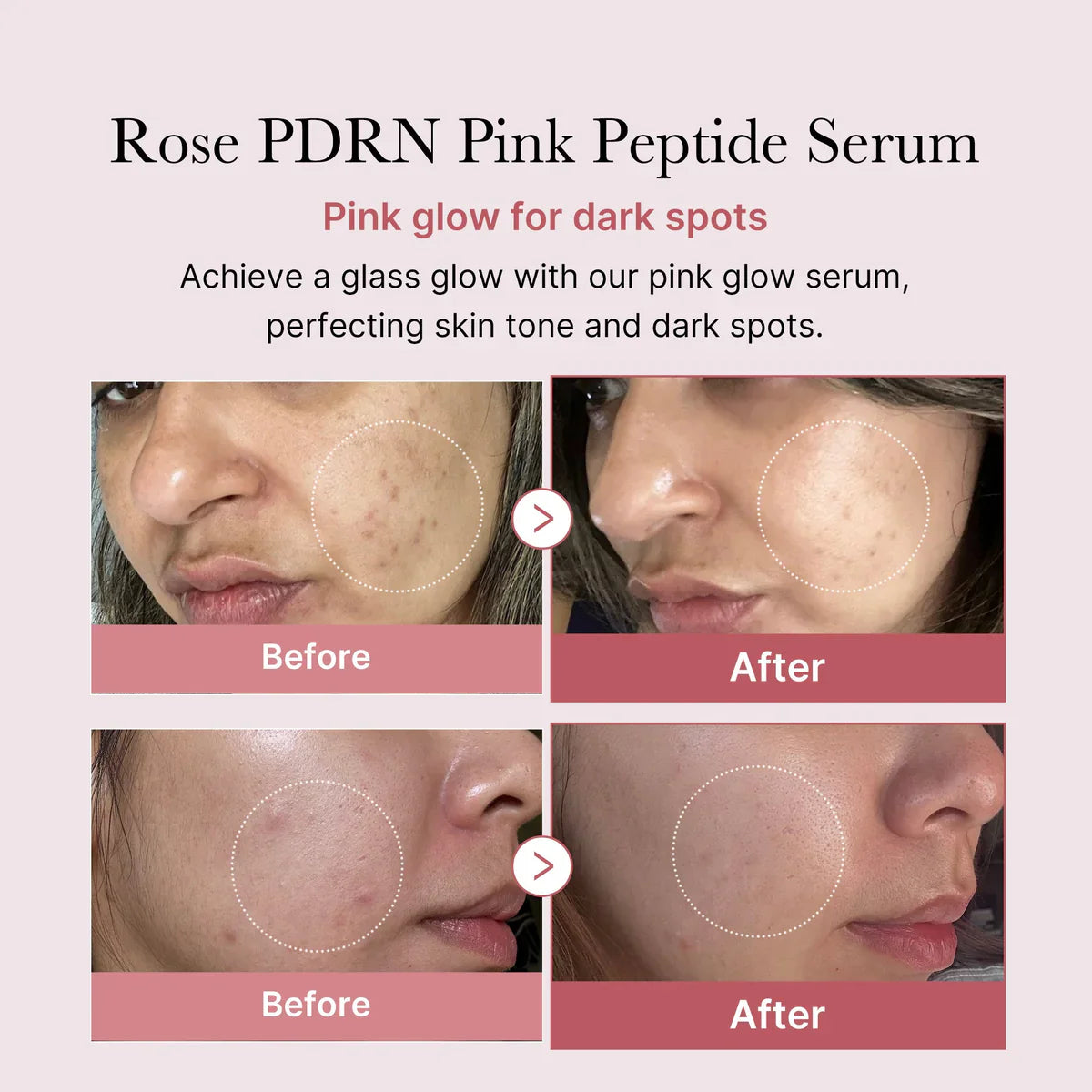 Korean Repair Serum, Anti Aging Serum, Skin Regeneration Serum, Hydrating Face Serum, Peptide Skincare,Glow Skin Serum, Firming Face Serum,Makeup Stash Pakistan
