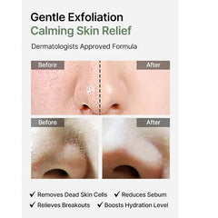 Heartleaf Extract, Exfoliating Toner Pads, Facial Peels, Hydrating, Troubled Skin & Breakouts , Makeup Stash Pakistan