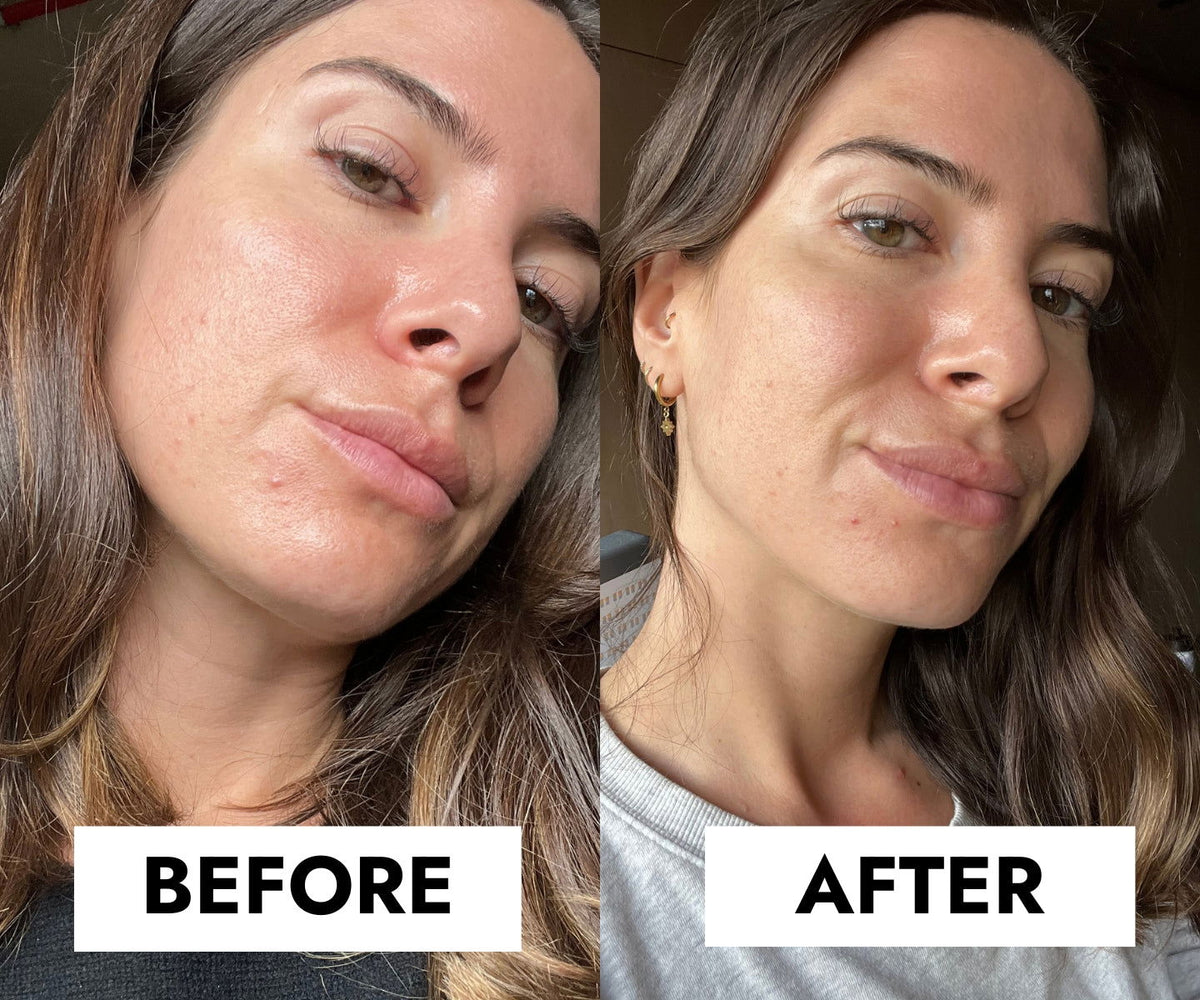 Blemish Control Cleanser, Salicylic Acid ,Face Was,Acne-Prone & Oily Skin , Ceramides & Niacinamide- Makeup Stash Pakistan