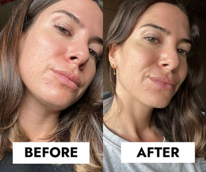 Blemish Control Cleanser, Salicylic Acid ,Face Was,Acne-Prone & Oily Skin , Ceramides & Niacinamide- Makeup Stash Pakistan