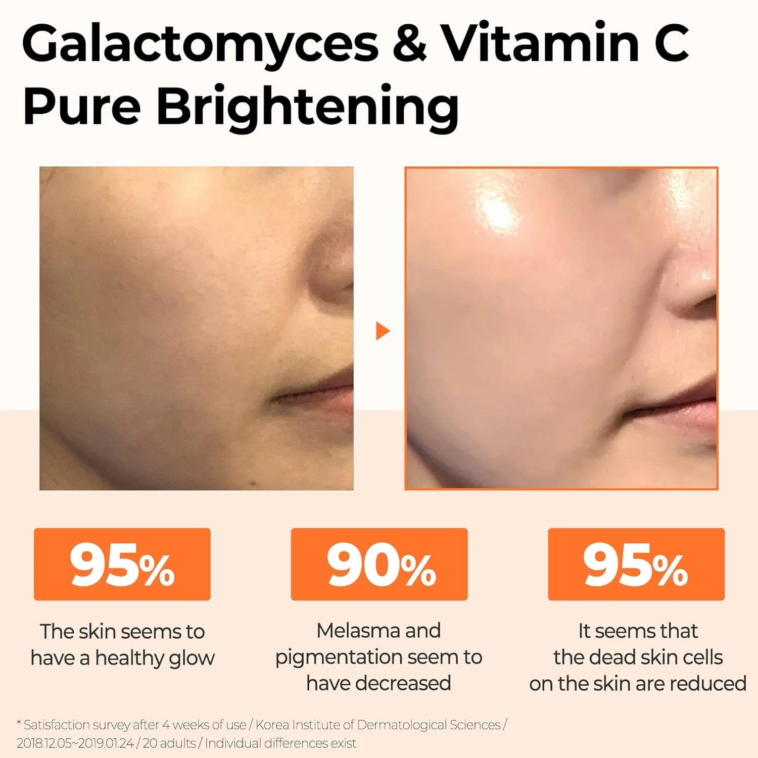 Vitamin C Serum, Glow Serum, Brightening Serum, Galactomyces Serum, Korean Skincare,Korean Beauty Products, Face Glow Serum, Anti Pigmentation Serum, Niacinamide Serum, Hydrating Glow Serum, Radiance Booster Serum, K Beauty Pakistan, Uneven Skin Tone Serum - Makeupstashpk