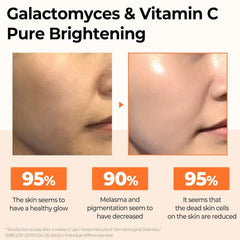 Vitamin C Serum, Glow Serum, Brightening Serum, Galactomyces Serum, Korean Skincare,Korean Beauty Products, Face Glow Serum, Anti Pigmentation Serum, Niacinamide Serum, Hydrating Glow Serum, Radiance Booster Serum, K Beauty Pakistan, Uneven Skin Tone Serum - Makeupstashpk