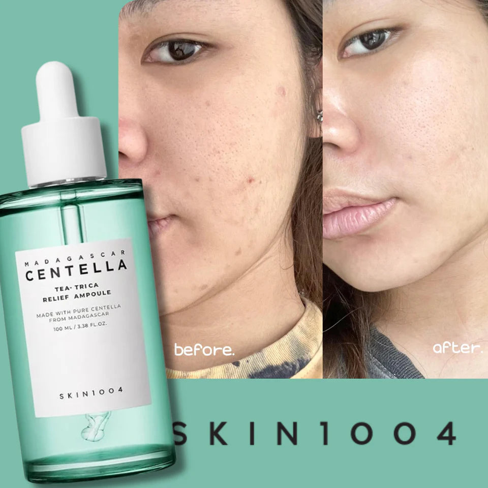 Skin1004 - Madagascar Centella Tea-Trica Relief Ampoule 100ml - Makeup Stash Pakistan