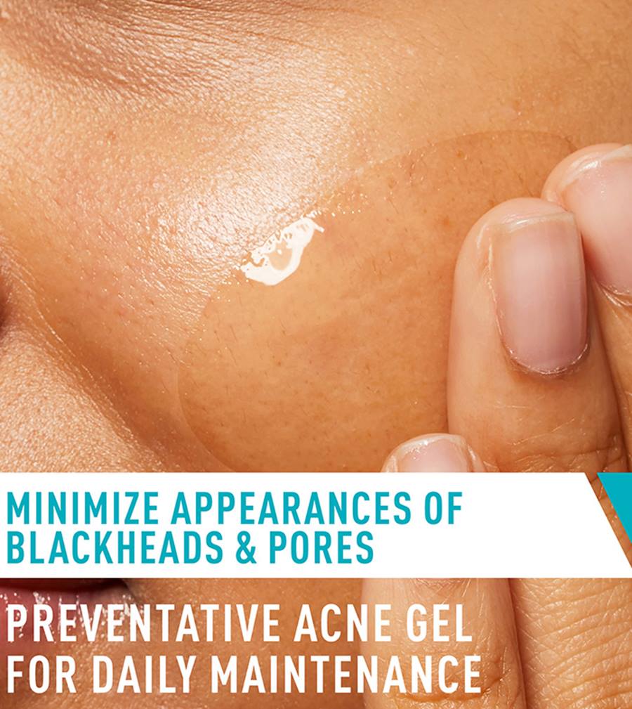 Salicylic Acid, Acne Treatment, Pore Refining Gel, Makeupstashpk