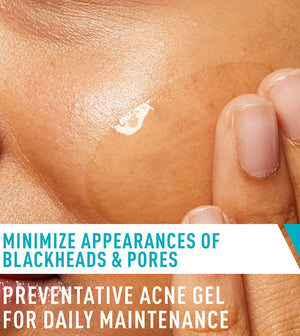 Salicylic Acid, Acne Treatment, Pore Refining Gel, Makeupstashpk