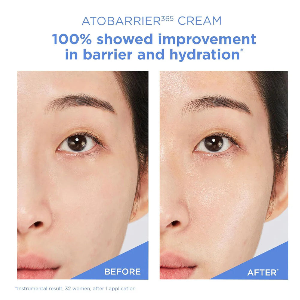 Aestura Atobarrier 365 Cream 80ml – Intensive Barrier Repair & Deep Moisture Cream