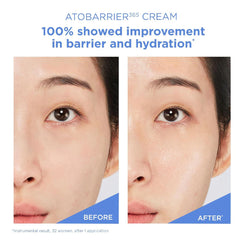 Aestura Atobarrier 365 Cream 80ml – Intensive Barrier Repair & Deep Moisture Cream