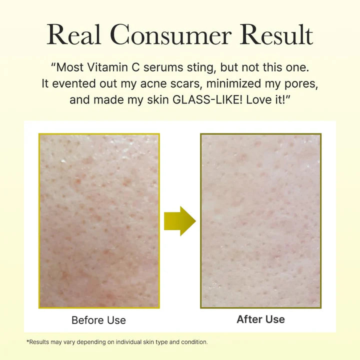 vitamin c serum, arencia serum, brightening serum, korean skincare, glow serum, dark spot serum, vitamin c booster shot, facial serum, skincare for glowing skin, uneven skin tone serum, antioxidant serum, hydrating serum, korean beauty products, skincare serum 30ml, radiant skin serum, acne marks treatment, skincare essentials, daily face serum, lightweight vitamin c serum, brightening skincare - Makeupstashpk