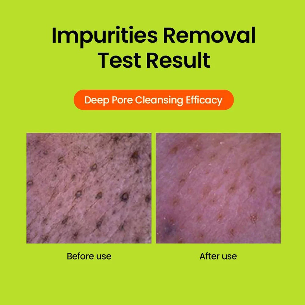 Beplain – Mung Bean Greenful pH balanced Cleansing Foam 80ml - Makeup Stash Pakistan