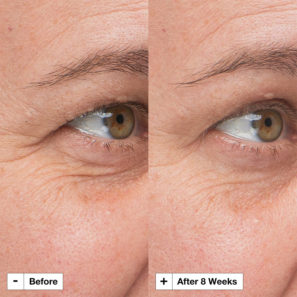 anti aging serum, firming serum, retinol alternative serum, Korean skincare serum, wrinkle reduction serum, skin firming treatment, K beauty Pakistan, sensitive skin anti aging, glow serum, smooth skin serum, collagen boosting serum