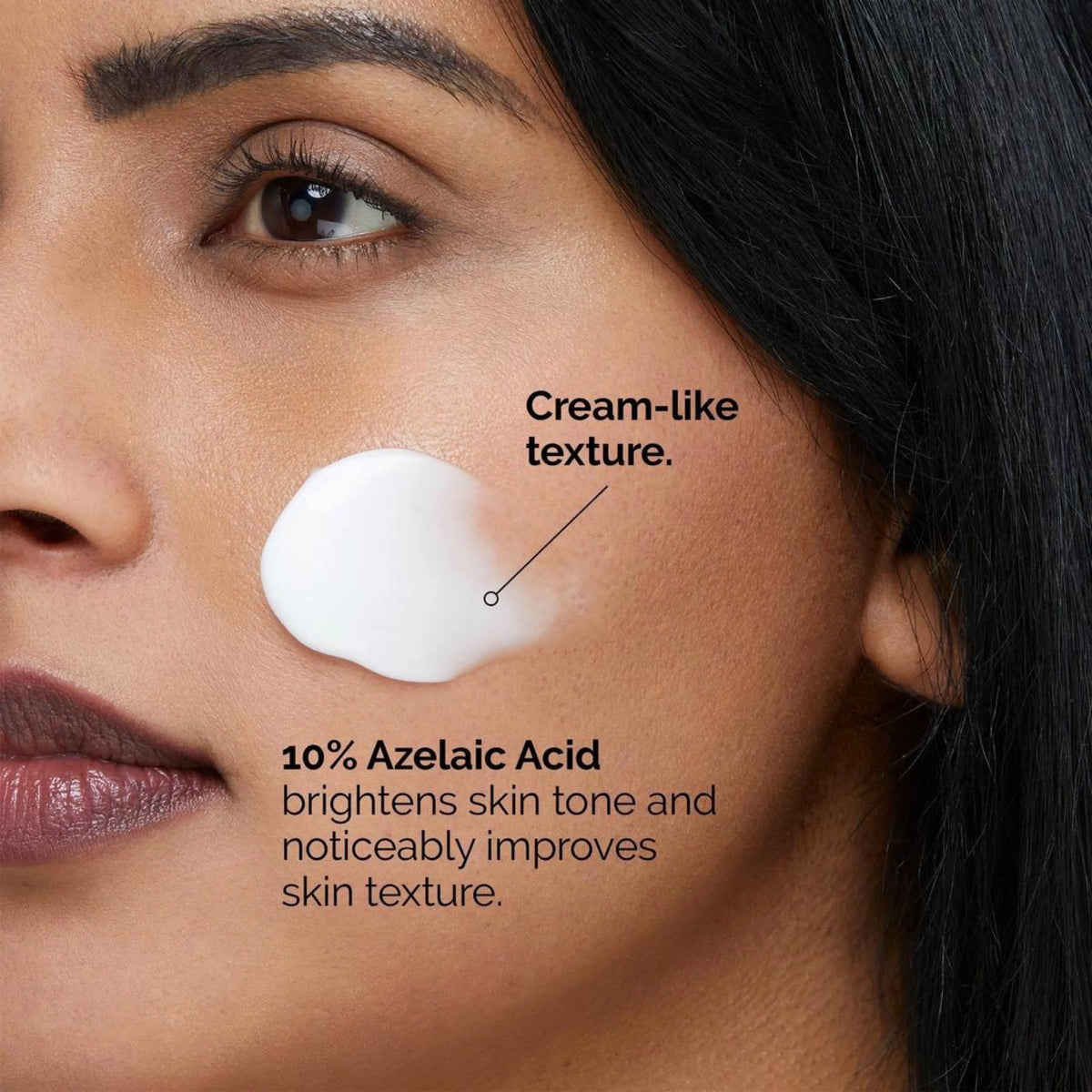 Acne Treatment Cream, Redness Relief Serum, Dark Spot Cream,Skin Brightening Cream, Post Acne Marks Treatment, Face Cream - Makeup Stash Pakistan