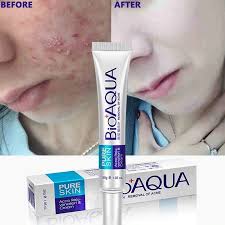 BIOAQUA Face Skin Care Anti Wrinkle Acne Removal Scar Cream Spots 30g  Makeup Stash Pakistan