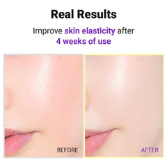 Isntree - Hyper Retinol Ex 1.0 Serum 20ml - Makeup Stash Pakistan
