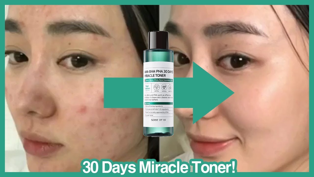 Some By Mi - AHA BHA PHA 30 Days Miracle Toner 150ml - Makeup Stash Pakistan