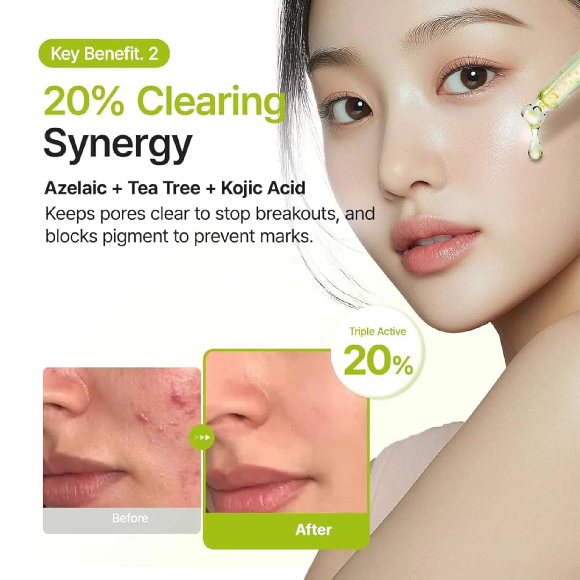 Purito,Azelaic Acid,Serum,Korean Serum,Brightening,Acne Care Treatment,Makeupstashpk