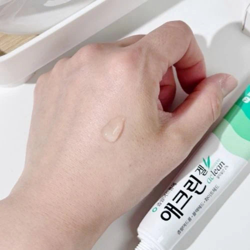  Acne Treatment Gel , Pimples , Blackheads , Oily Skin, Makeup Stash Pakistan