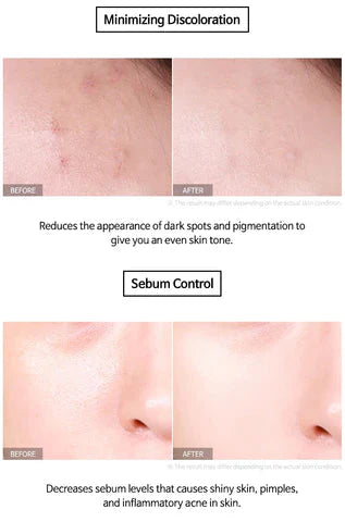 Niacinamide, Brightening Serum,Dark Spots, Acne Marks, Even Skin Tone - Makeup Stash Pakistan